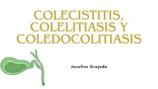 Colecistitis, colelitiasis y coledocolitiasis