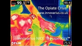 The Opiate Crisis Solution by Innovarius NICE Therapeutics™