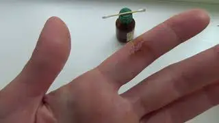 I was bitten by my rat! The attack was caught on camera!