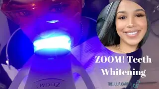 ZOOM! Professional Teeth Whitening | Dentist Recommended | My Experience