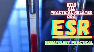 Erythrocyte Sedimentation Rate (ESR); What Does This Lab Test Really Mean? With Related All Q&As