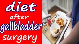 Diet after Gallbladder Surgery | Do's and Don't