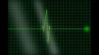 ecg machine sound effect no copyright