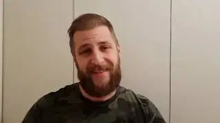 Hair Transplant Turkey Result after 19 Weeks