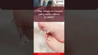 PERTOLONGAN PERTAMA PADA LUKA BAKAR #shorts #burn #luka #firstaid