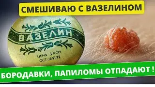Как избавиться от ПАПИЛЛОМ, БОРОДАВОК и других кожных образований народными средствами за 1 день!