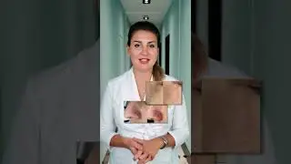 Акция от Uclinic СКИДКА 10% на фототерапию | аппарат Candela Nordlys