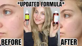 I Tried The Good Molecules Discoloration Correcting Serum For 5 Weeks (NEW FORMULA)