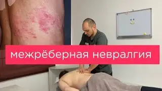 Межрёберная Невралгия.Больно дышать.Боль в боку. Миофасциальный синдром. Миопрессура