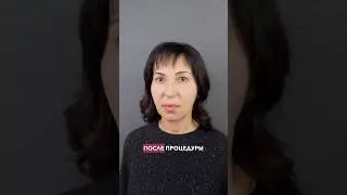 Минус 10 лет за одну процедуру