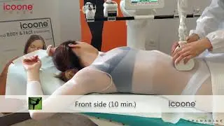 Icoone® Laser, trattamento Base| SpaMarine di Senigallia