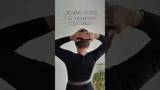 #fdm