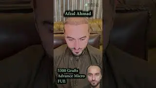 4th Post-Op Day & Review: Afzal Ahmad’s Hair Transplant Journey!