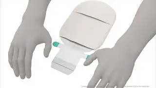 Hvordan bruke SenSura® Mio Concave tømbar stomipose