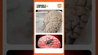 Know Your Brain #KhulKe| Who can suffer a brain stroke?| Unknown Facts of the Human Brain