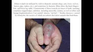 tumor 29.04.2022