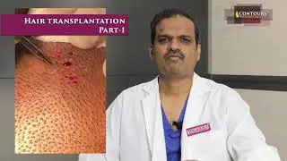 Hair transplantation Part - 1| Dr Venkata Ramana Yamini