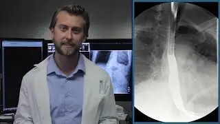 Upper GI Series Patient Education Video