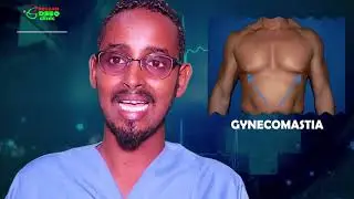 Naasa bararka raga | xalka naasaha waaweyn ee raga | Gynecomastia
