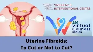 Uterine Fibroids Embolisation: To Cut or Not to Cut? (ESG Women's Webinar)