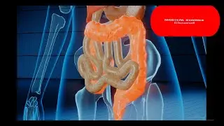 what is colonoscopy? how is colonoscopy done? #colonoscope