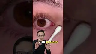 O Que é Isso no Olho? 😯👁️