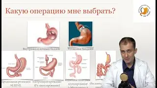 Похудение с помощью бариатрической операции. Самые эффективные и безопасные бариатрические операции.