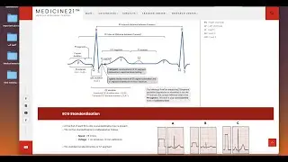Normal values of ECG and heart rate calculation