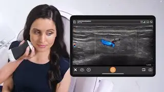 Ultrassom Ultra Portátil em Estética Facial | Mobissom/Clarius