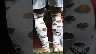 Зачем футболистам дырки в гетрах? // Помогают ли дырявые гетры футболистам?