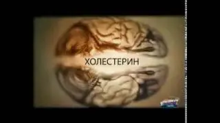 Мифы и правда о холестерине !