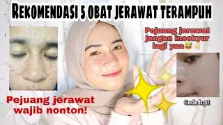 OBAT JERAWAT TERAMPUH | PEJUANG JERAWAT WAJIB NONTON! ✌🏻
