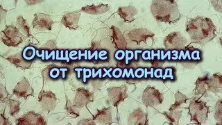 ОЧИЩЕНИЕ организма от ТРИХОМОНАД по методу Трескунова