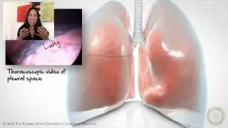 7. The Lungs and Pleurae