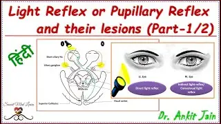 Light reflex pathway and lesions (Part-1/2) in Hindi // pupillary light reflex pathway and lesions