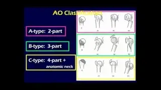 Proximal Humerus Fractures 1 (OTA lecture series III u03a)