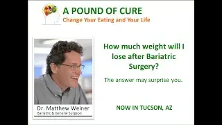 How much weight will I lose after Bariatric Surgery - The answer may surprise you