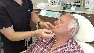 Rhinophyma Treatment at Shannon Clinical Aesthetics