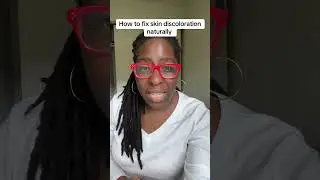 Skin discoloration can be fixed with these 2 things