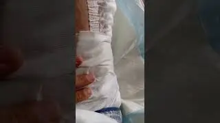 Обжёг себе ногу кипятком