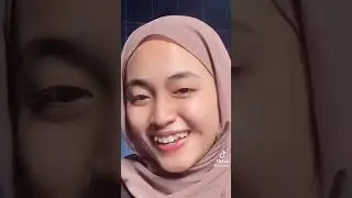 Tiktok cantik gigi gingsul viral