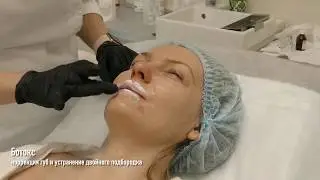 Инъекции ботокса, коррекция губ и устранение двойного подбородка