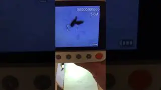 Lice and Nits under a microscope. Real Head Check Evidence.