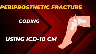 PERIPROSTHETIC FRACTURE CODING USING ICD-10 CM