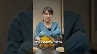 Специи для суставов!
