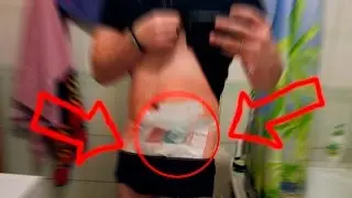 МОЯ ПЕРВАЯ ОПЕРАЦИЯ!