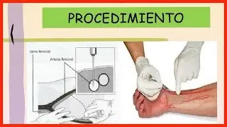 Cómo tomar gasometría, Punción Arterial |Enfermería