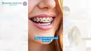 🦷 Malalignment: Its Effects & Prevention | By Dr. Kapil Gupta, Smirk Dental
