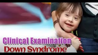 Examining A Child with Down Syndrome - Clinical Exam Revision