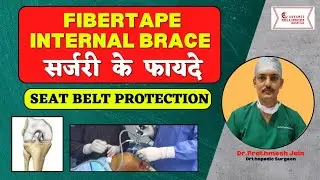 FIBERTAPE INTERNAL BRACE:  Everything you want to know in Detail (Hindi)
